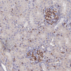 Anti-ARAP3 Antibody