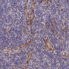 Anti-ARAP3 Antibody