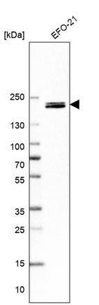 Anti-ARAP3 Antibody