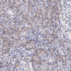 Anti-REPS2 Antibody