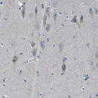 Anti-ANKFN1 Antibody