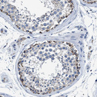 Anti-ANKFN1 Antibody