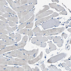 Anti-ANKFN1 Antibody