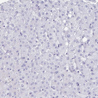 Anti-HDGFL1 Antibody