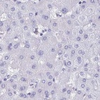 Anti-HDGFL1 Antibody