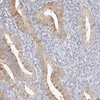 Anti-ITGB3 Antibody