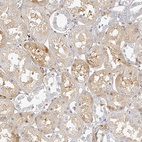 Anti-ITGB3 Antibody