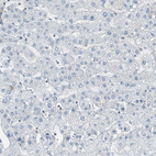 Anti-TOP2A Antibody