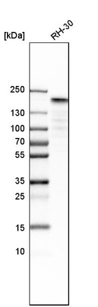 Anti-TOP2A Antibody