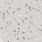 Anti-ENTPD4 Antibody