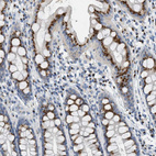 Anti-ENTPD4 Antibody