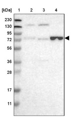 Anti-ENTPD4 Antibody