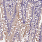 Anti-MIDN Antibody