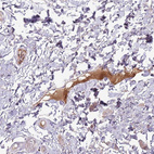 Immunohistochemical staining of human skin shows strong positivity in plasma.