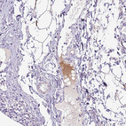 Immunohistochemical staining of human lymphoid tissues shows strong positivity in plasma.