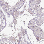 Immunohistochemical staining of human testis shows weak cytoplasmic positivity in Leydig cells.