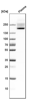 Western blot analysis in human plasma.