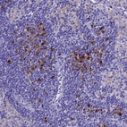 Anti-IGSF6 Antibody