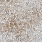 Anti-TMEM260 Antibody