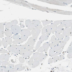 Anti-TMEM260 Antibody