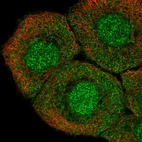 Anti-TMEM260 Antibody