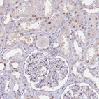 Immunohistochemical staining of human kidney shows moderate nuclear/nuclear membranous positivity in cells in tubules.