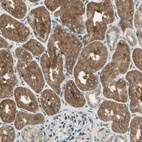 Immunohistochemical staining of human kidney shows strong cytoplasmic positivity in cells in tubules.