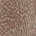 Immunohistochemical staining of human liver shows strong cytoplasmic positivity in hepatocytes.