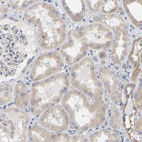 Anti-MINDY4 Antibody