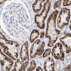 Anti-ACOT13 Antibody