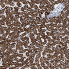 Anti-ACOT13 Antibody