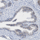 Anti-ACOT13 Antibody