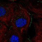 Anti-ACOT13 Antibody