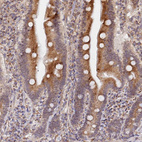 Anti-VSTM2L Antibody