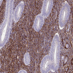 Anti-ADIPOQ Antibody