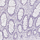 Immunohistochemical staining of human rectum shows no positivity in glandular cells as expected.