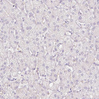 Immunohistochemical staining of human liver shows no positivity in hepatocytes as expected.