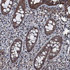 Anti-FAAP24 Antibody