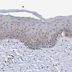 Anti-BZW2 Antibody