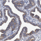 Anti-BZW2 Antibody