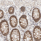 Anti-DNAJC7 Antibody