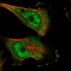 Anti-DNAJC7 Antibody