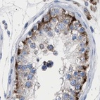 Anti-HSD17B4 Antibody