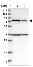 Anti-HSD17B4 Antibody