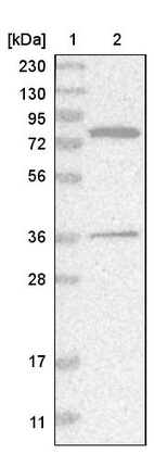 Anti-HSD17B4 Antibody