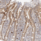 Anti-AFDN Antibody