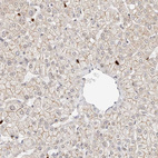 Anti-AFDN Antibody