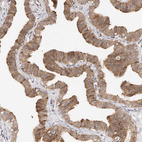 Anti-AFDN Antibody