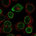 Anti-CPNE1 Antibody