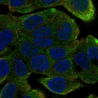 Anti-DNAAF4 Antibody